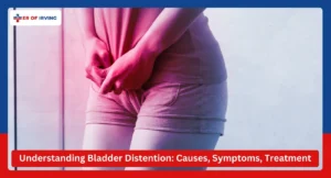 Understanding Bladder Distention Causes, Symptoms, and Treatment Options