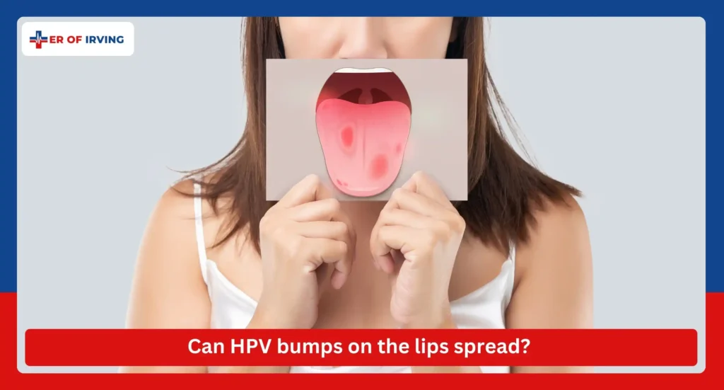 HPV Bumps on Tongue: Understanding Its Causes, Types, and Treatment 3 HPV Bumps on Tongue: Understanding Its Causes, Types, and Treatment Can HPV bumps on the lips spread