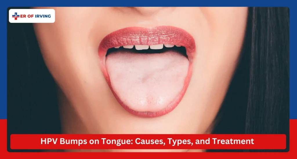 HPV Bumps on Tongue: Understanding Its Causes, Types, and Treatment 1 HPV Bumps on Tongue: Understanding Its Causes, Types, and Treatment HPV Bumps on Tongue Causes, Types, and Treatment