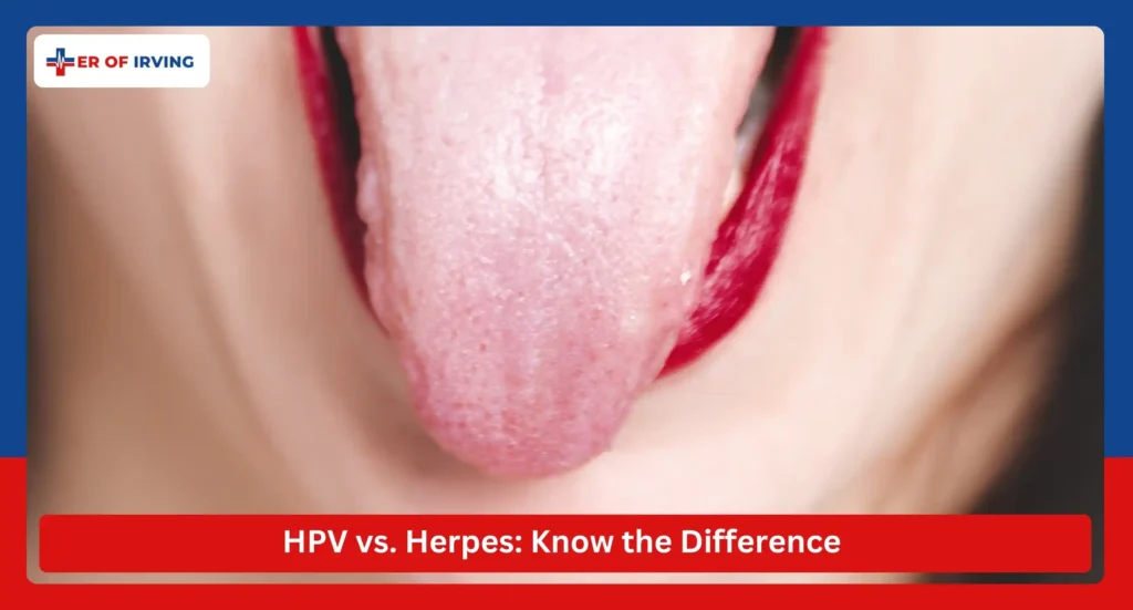 HPV Bumps on Tongue: Understanding Its Causes, Types, and Treatment 2 HPV Bumps on Tongue: Understanding Its Causes, Types, and Treatment HPV vs. Herpes Know the Difference