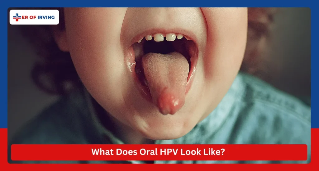 HPV Bumps on Tongue: Understanding Its Causes, Types, and Treatment 1 HPV Bumps on Tongue: Understanding Its Causes, Types, and Treatment What Does Oral HPV Look Like
