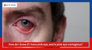 How do I know if I have pink eye, and is pink eye contagious