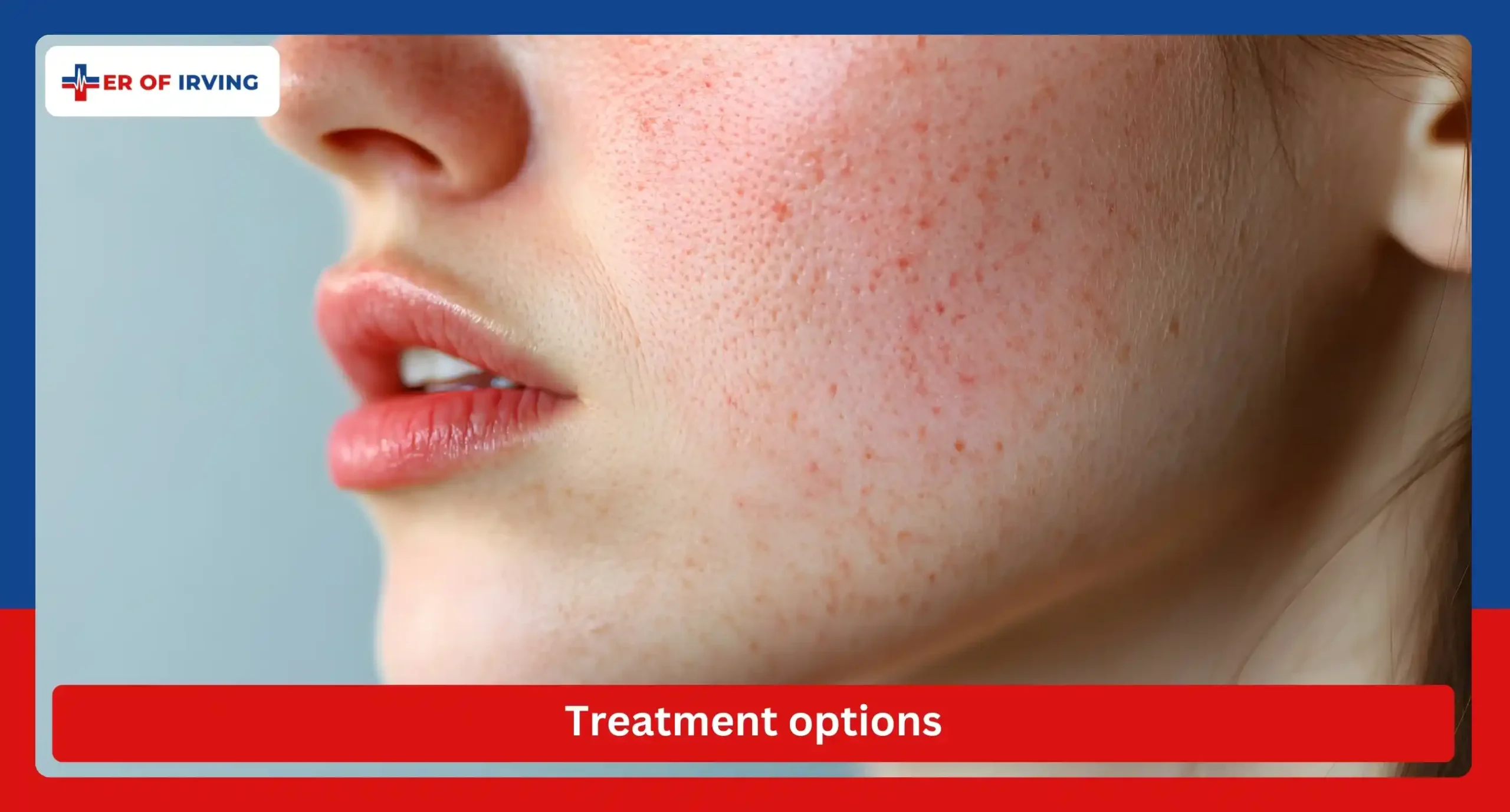Red circle on skin, not ringworm? Here’s when to visit the ER of Irving 2 Red circle on skin, not ringworm? Here’s when to visit the ER of Irving Treatment Options